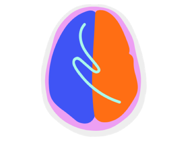 Brain Scan